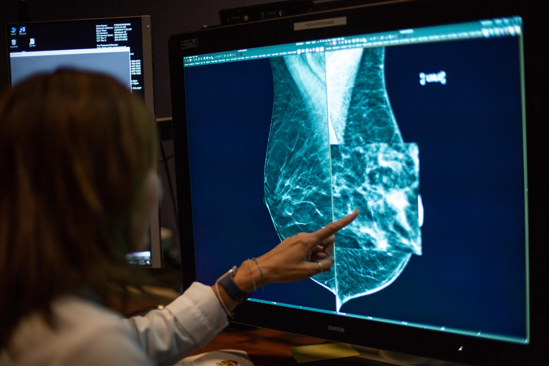 Screening. Cancer Screening. Mammograms публично. GDV Screening. Mammogram Darknet.