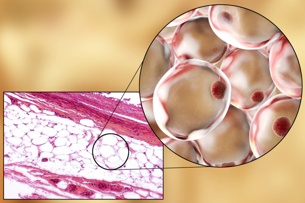 Νέα έρευνα συνδυάζει τη λειτουργία των λιποκυττάρων με τη γονιδιακή επεξεργασία 