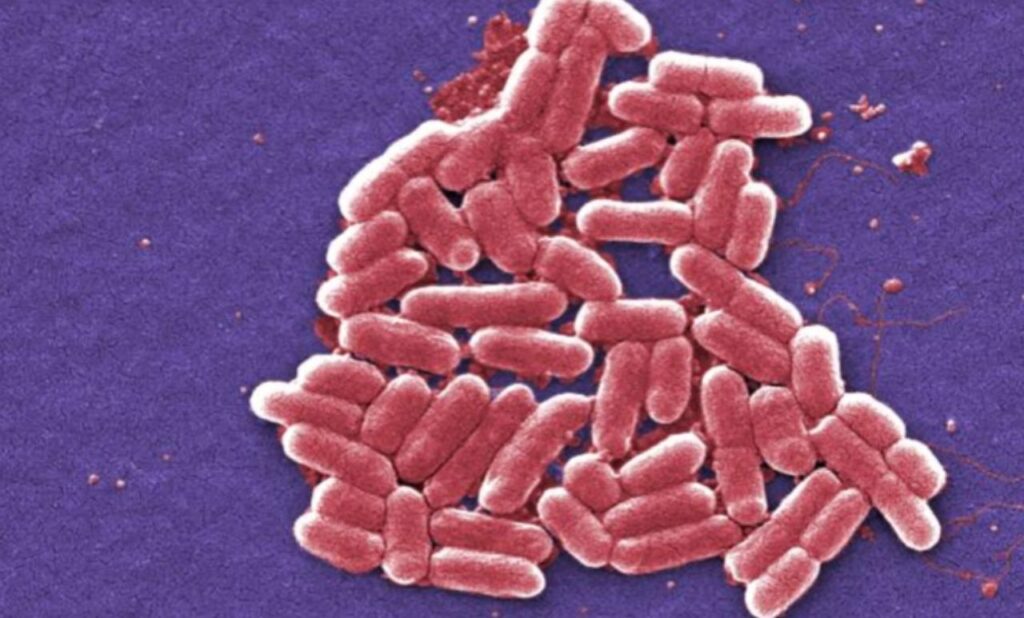 Το CDC ερευνά την επιδημία του E. coli στο Μίσιγκαν και το Οχάιο που έχει μολύνει σχεδόν 30 άτομα