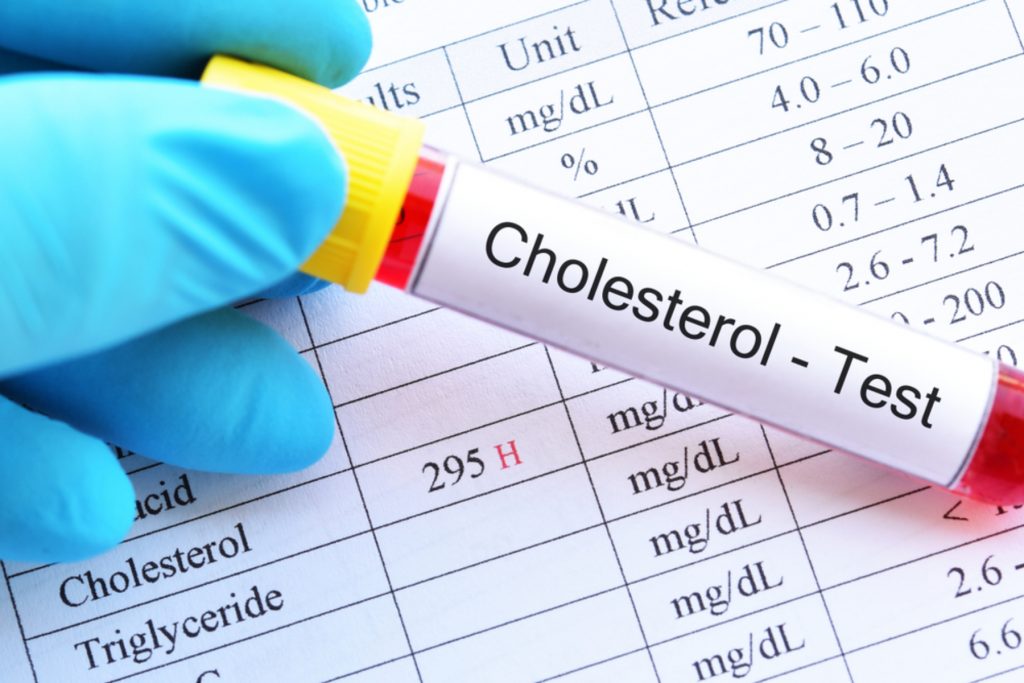 Είναι απαραίτητη η χοληστερόλη για το αίμα μας;