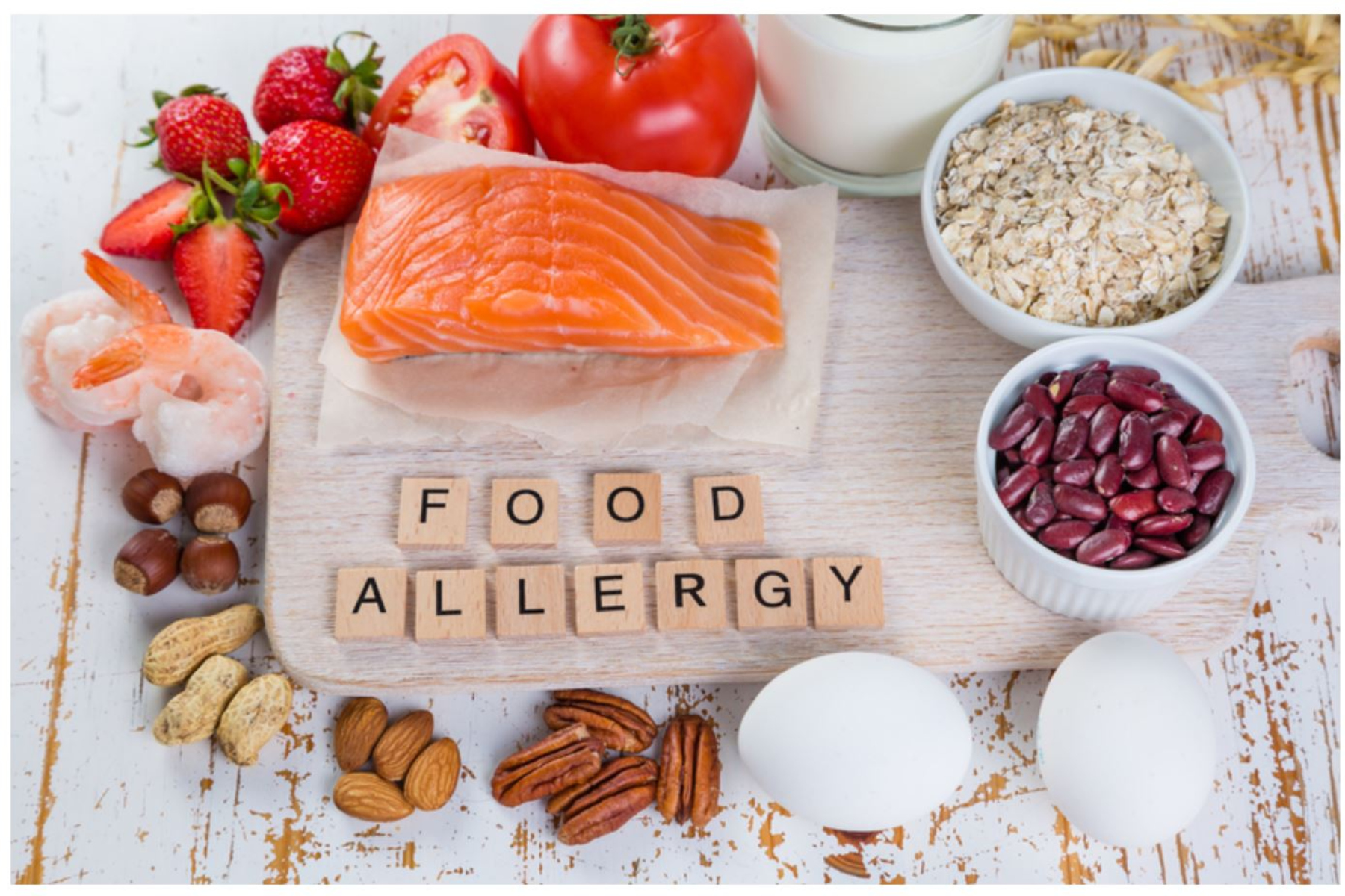 Αλλεργίες: Ποια είναι τα πιο γνωστά τρόφιμα που μπορούν να προκαλέσουν αλλεργίες;