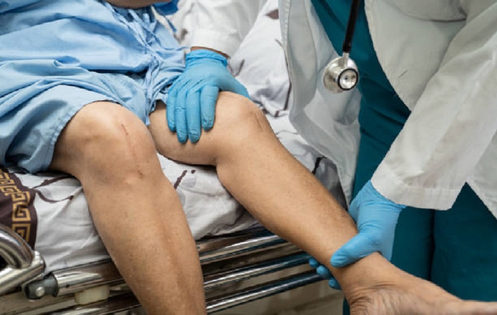 Οστεοαρθρίτιδα: Η αμφίπλευρη ολική αρθροπλαστική γόνατος συνδέεται με αυξημένα ποσοστά επιπλοκών