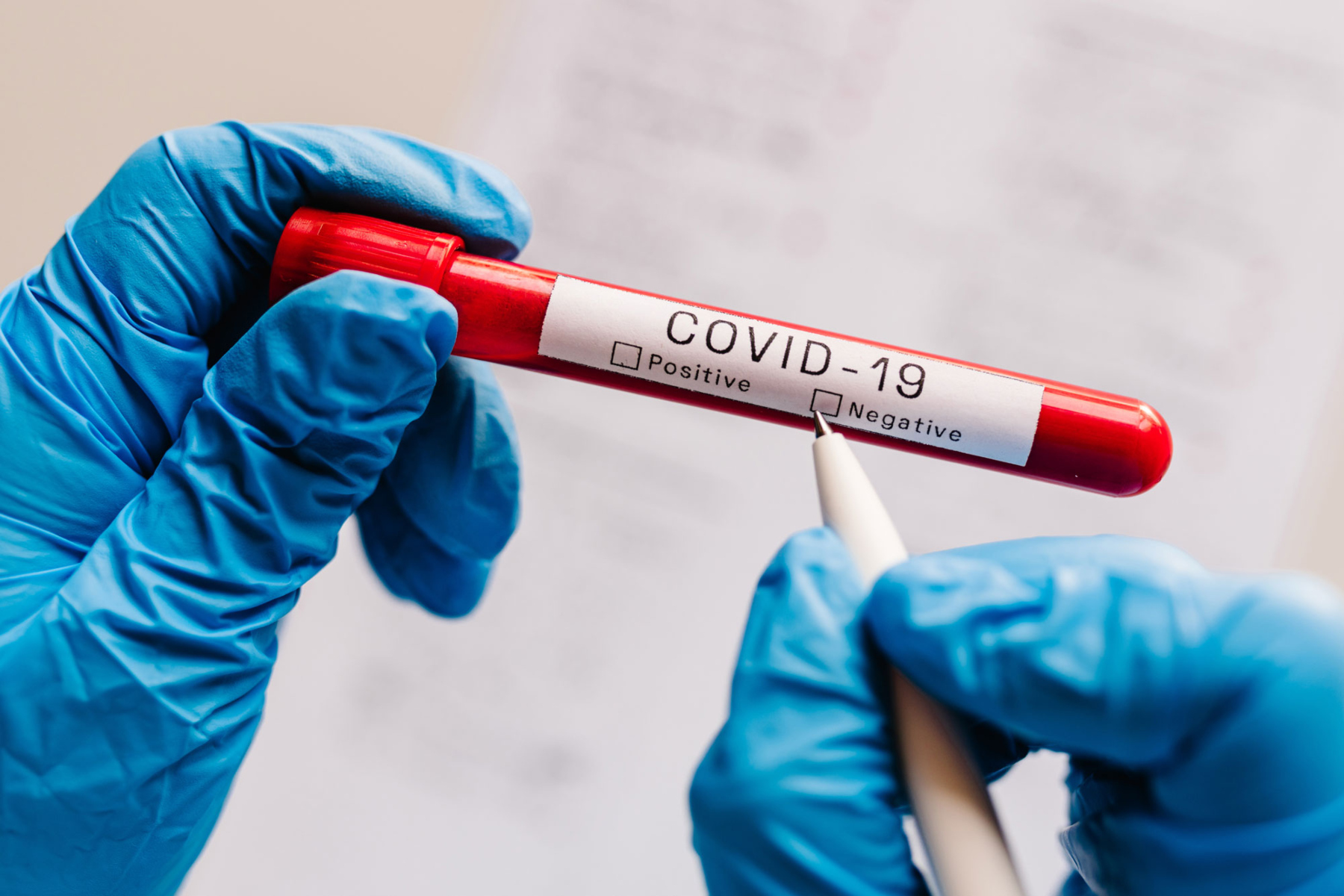 Covid-19: Πώς οι εξετάσεις αίματος βοηθούν στην θεραπεία για τον Covid-19;