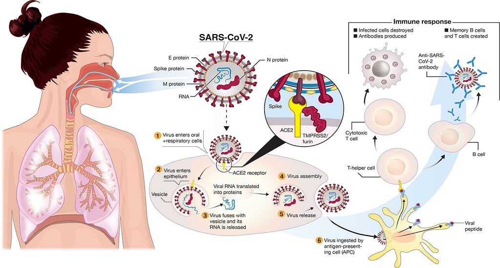 SARS-CoV-2: Μολύνει τον οφθαλμικό ιστό, αλλά η φλεγμονή απουσιάζει από τα μάτια των ασθενών που πέθαναν από COVID-19