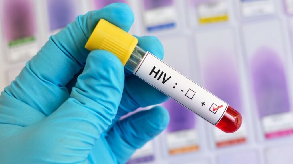 Πώς ο HIV εισέρχεται στο κέντρο του κυττάρου για να ξεκινήσει τη μόλυνση;