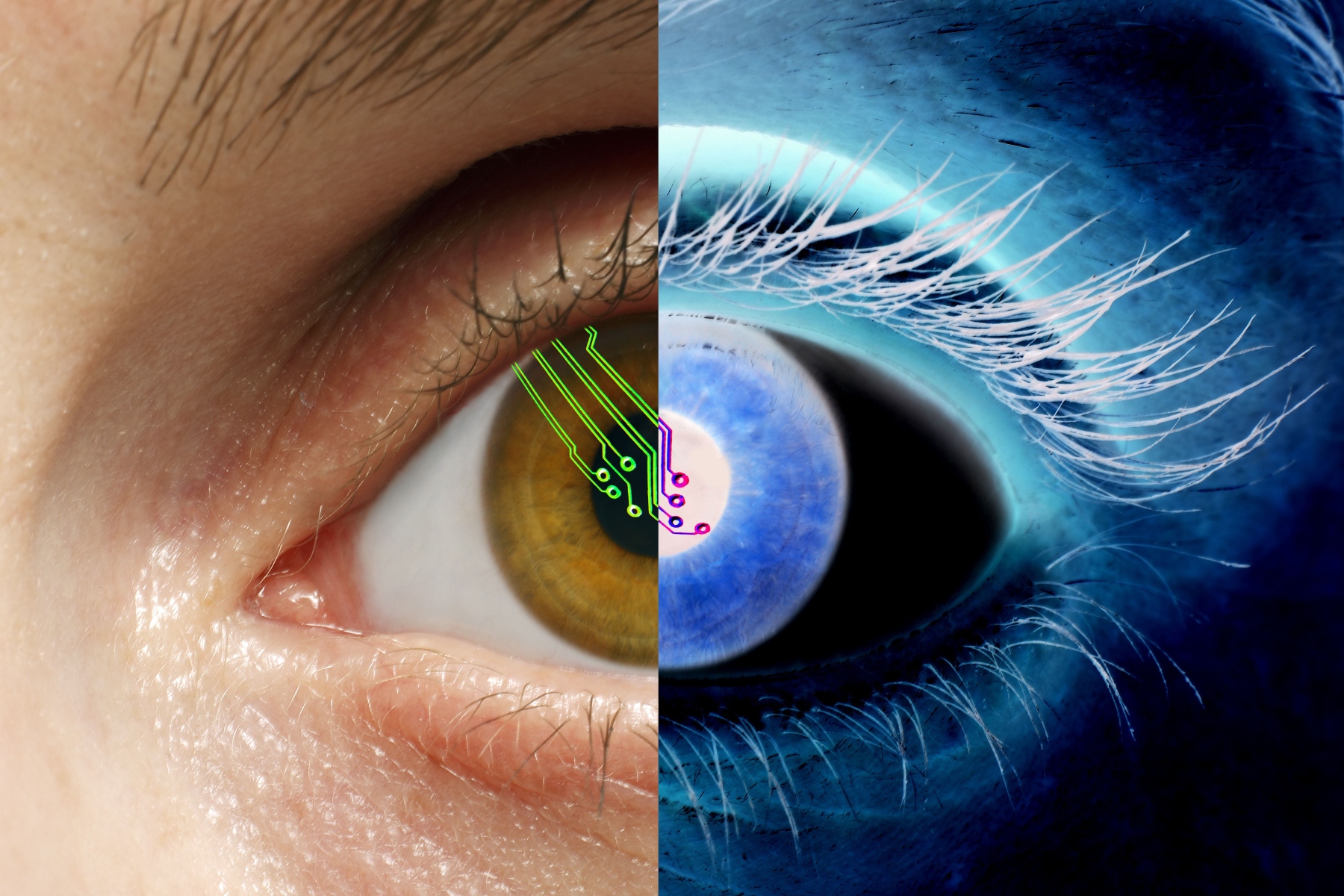 Βιονικό μάτι: Αποκαλύπτει σημαντικές βελτιώσεις στην όραση σε διάστημα 2,5 ετών