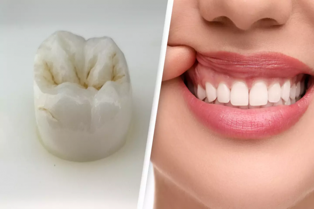 Νέα έρευνα οδηγεί στην αναγέννηση των δοντιών
