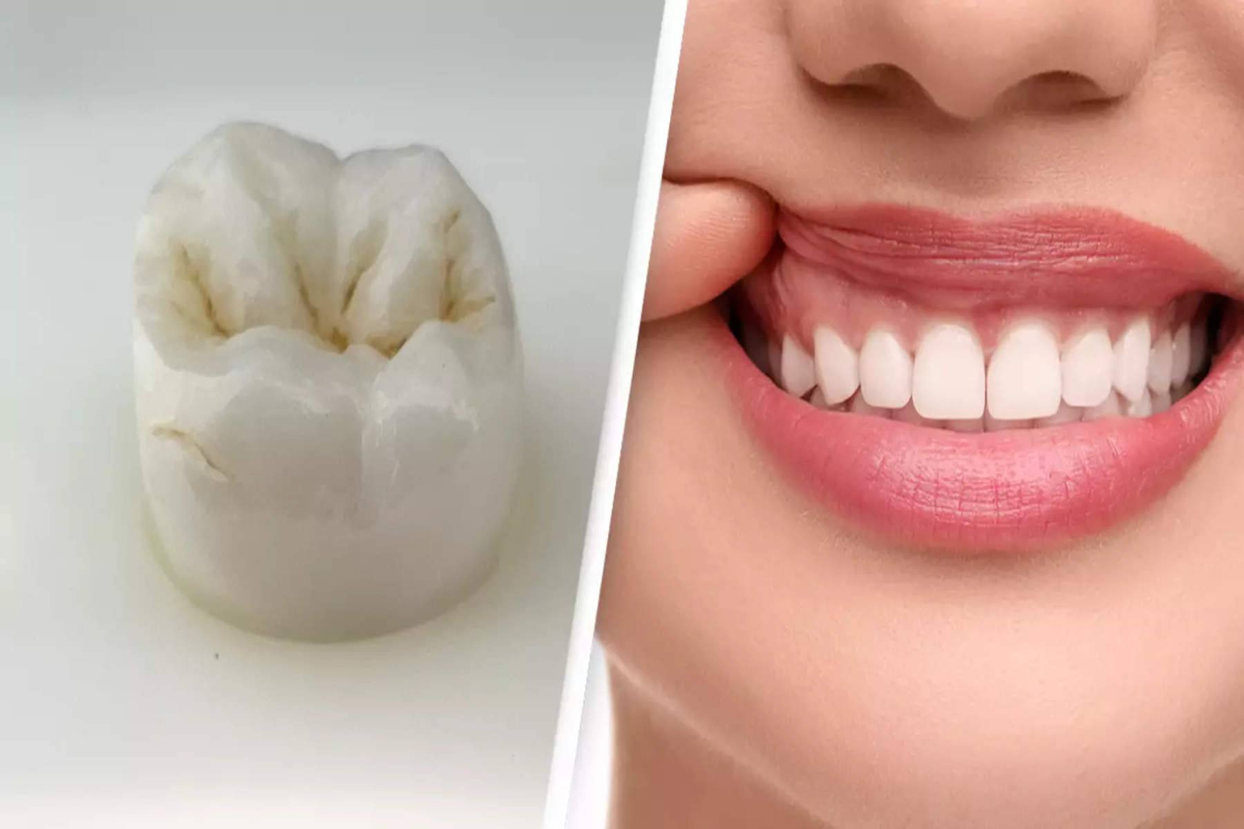 Οδοντοστοιχία: Νέα έρευνα οδηγεί στην αναγέννηση των δοντιών
