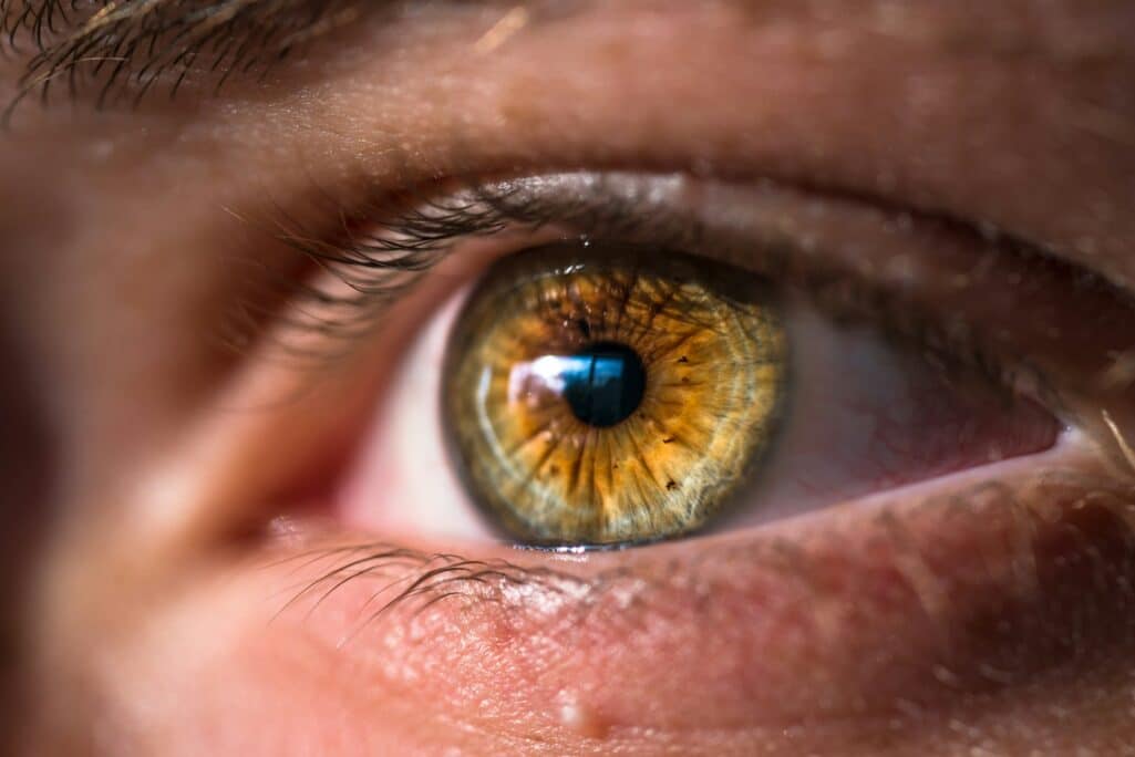 Καταρράκτης: Επτά βήματα για την πρόληψη της οφθαλμικής πάθησης