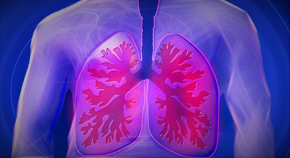 Πνευμονική Νόσος: Δεν είναι μόνο ο καπνός και η σκόνη που μπορούν να την προκαλέσουν
