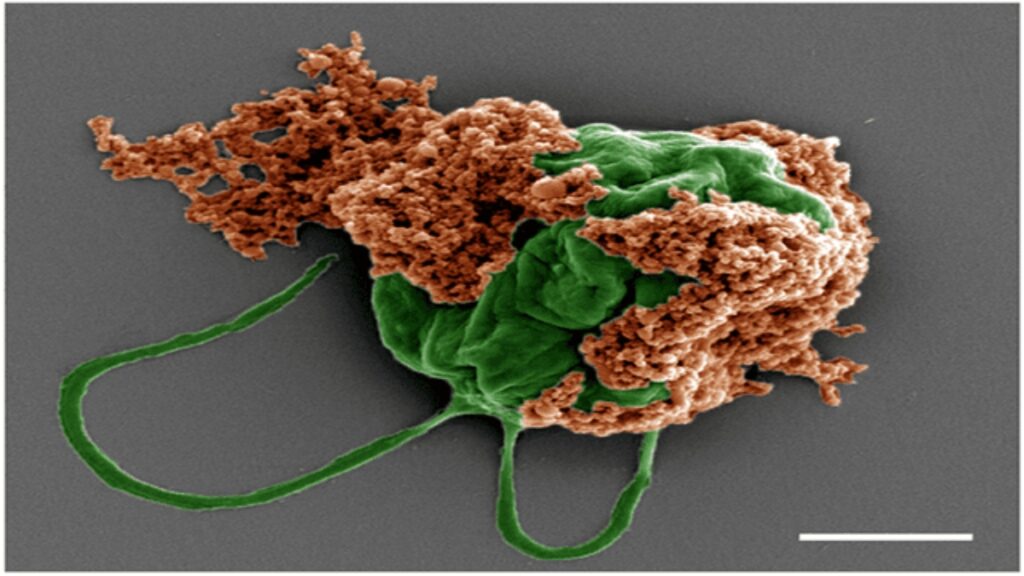 Καρκίνος Ρομποτική: Μικρορομπότ από φύκια παραδίδουν φάρμακα απευθείας σε καρκινικούς όγκους