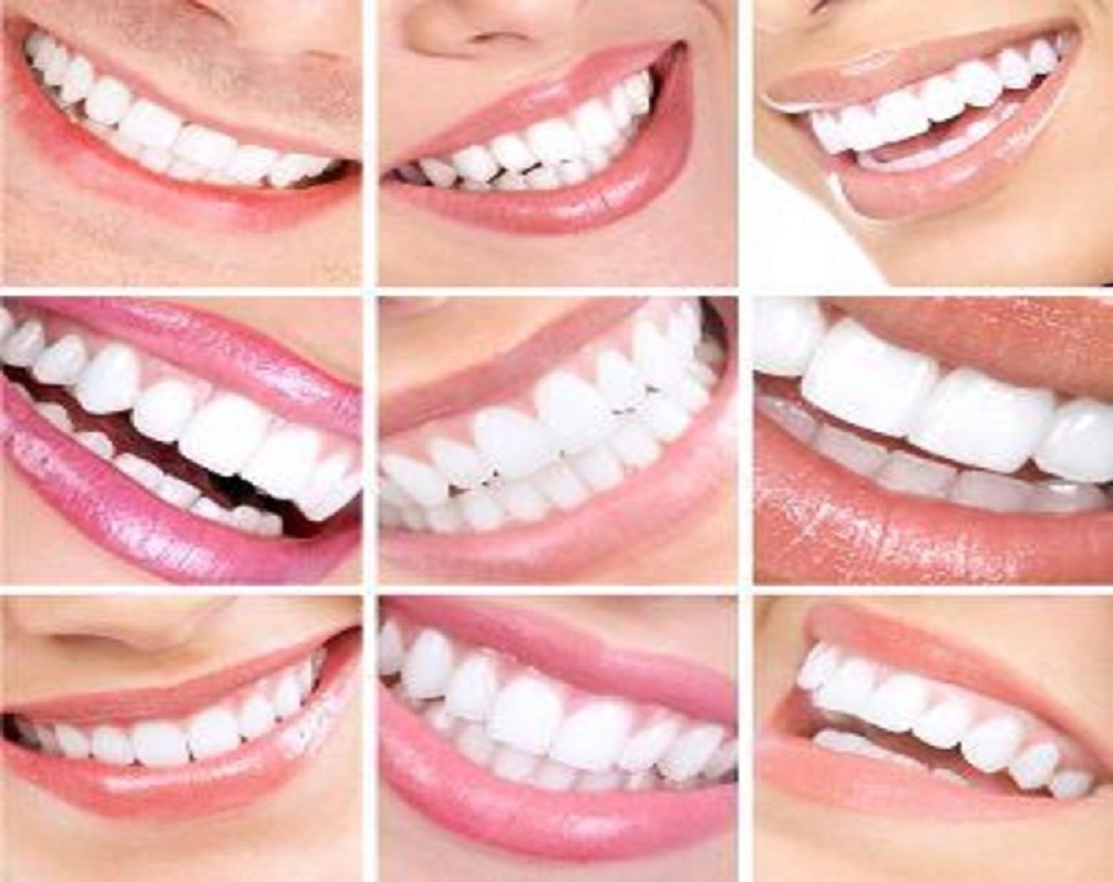 Όψεις, Εμφυτεύματα και Βασανιστικός Πόνος: Οι κίνδυνοι της αισθητικής οδοντιατρικής δεν προκαλούν χαμόγελο