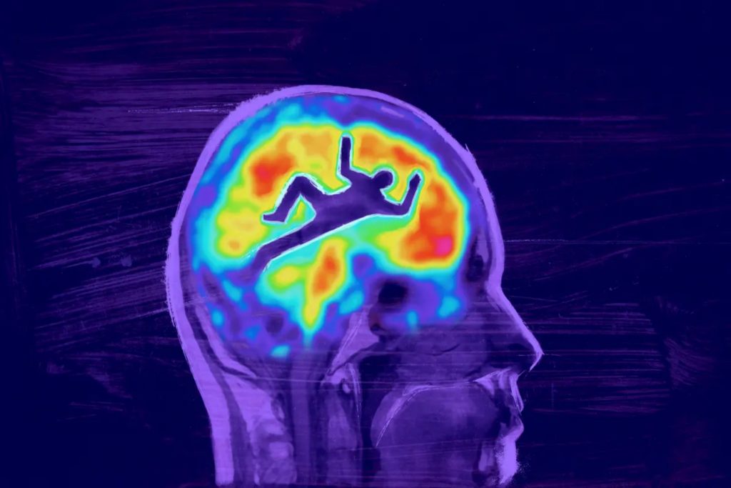 Μελέτη σάρωσης εγκεφάλου ρίχνει φως στο μυστήριο της ψυχικής υγείας