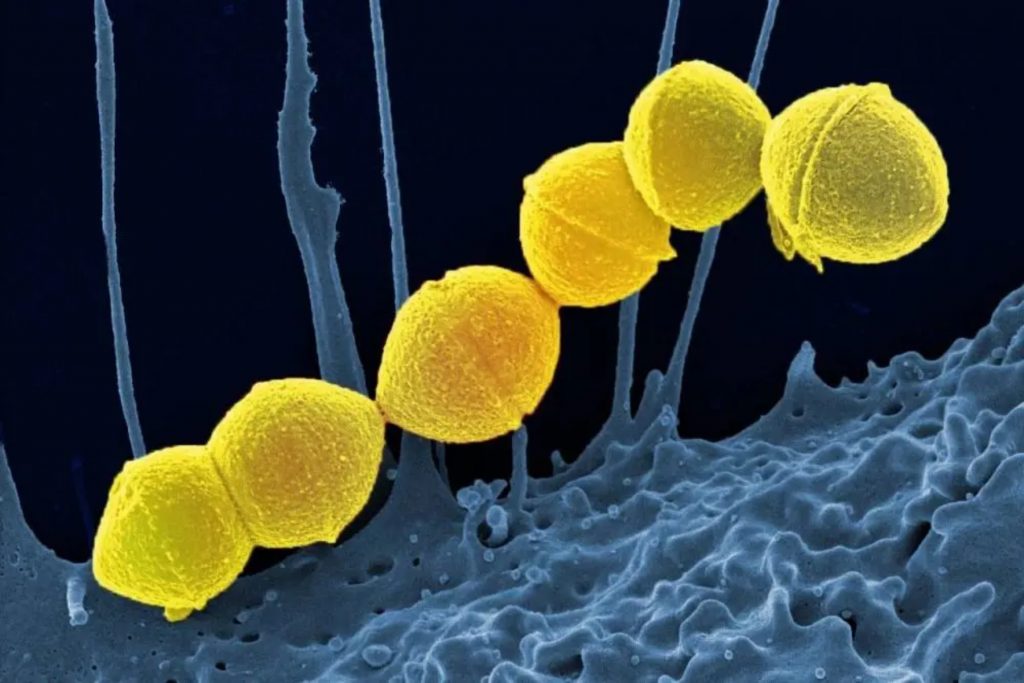 Σπάνια βακτήρια που τρώνε σάρκα εξαπλώνονται στην Ιαπωνία