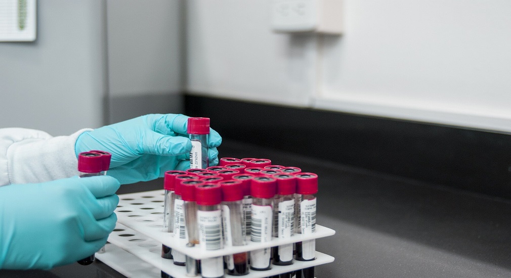 Βιταμίνη D: Το CDC αναφέρει τις δεκαετείς προσπάθειές του για την τυποποίηση των δοκιμών