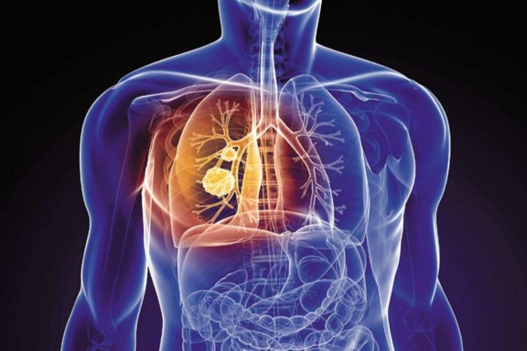 Χρόνια αποφρακτική πνευμονοπάθεια: Πώς το κάπνισμα ενεργοποιεί τη ΧΑΠ και συμβουλές διαχείρισης